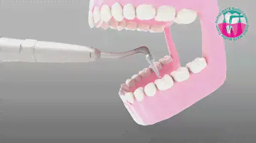 NSK Perio-Mate Product Video